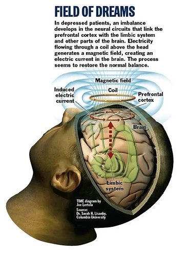 brain 14