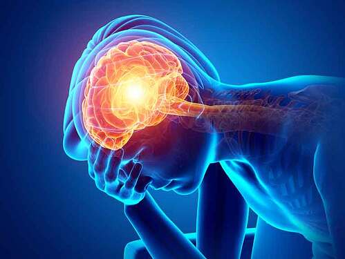 brainandpainshutterstock_603101843768x576